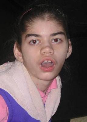 Alexis Long